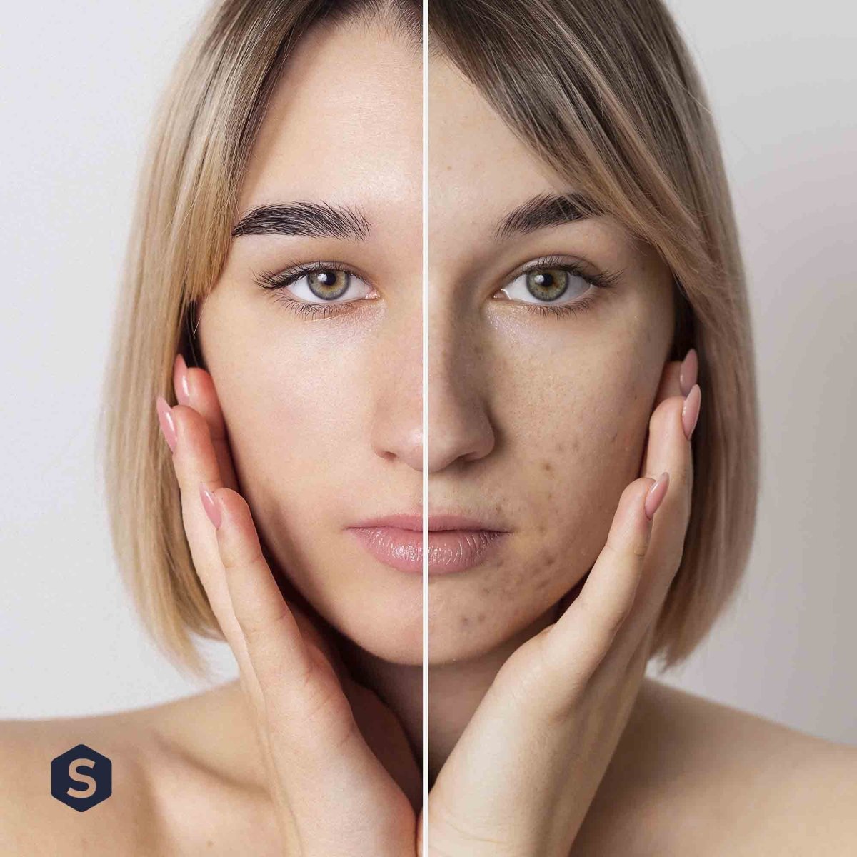 Cure PEAU® | Éclat de la Peau | Onagre Bourrache Polyphénols Phytocéramides | 120 gélules 30j - Suplemint